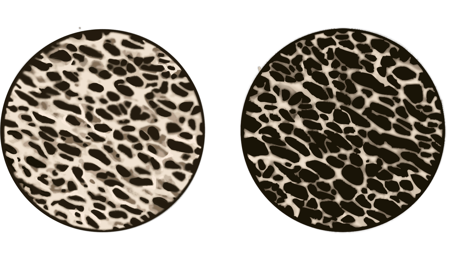 Bone+Marrow.png.webp