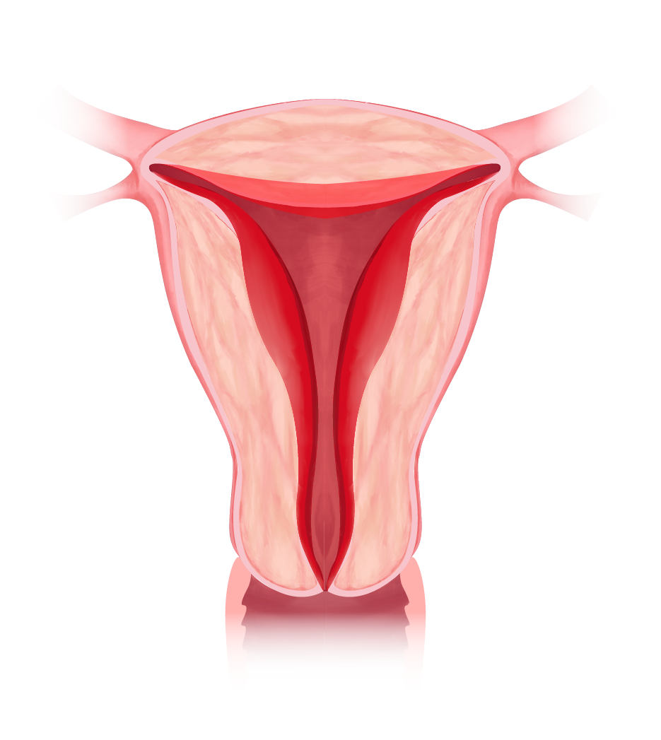 Uterus-endo.png
