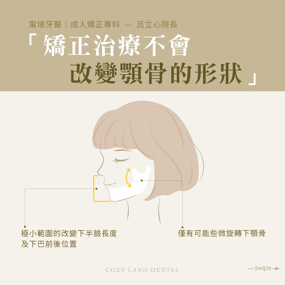 矯正不會改變顎骨說明圖 3｜一般矯正無法明顯改變顎骨形狀，需正顎手術