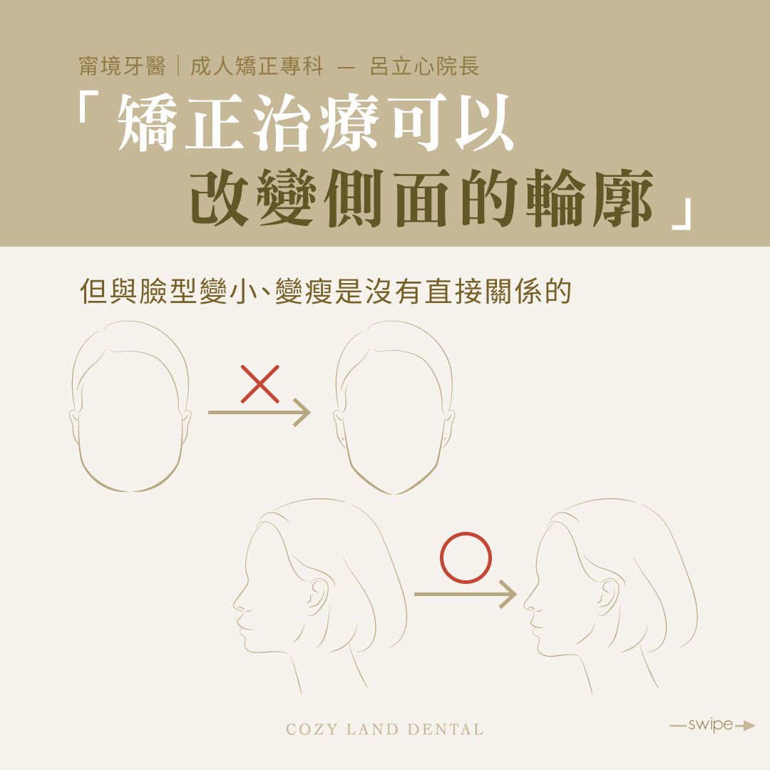 矯正可改變側面輪廓說明圖 4｜牙齒矯正對側顏輪廓的影響範圍說明