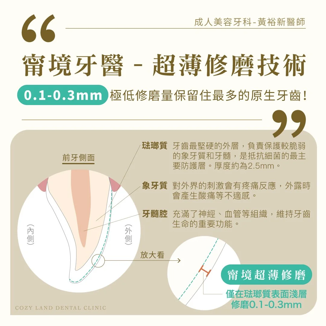 超薄修磨技術對比圖 2｜一般貼片磨 0.5–0.9mm vs 甯境磨 0.1–0.3mm 差異說明