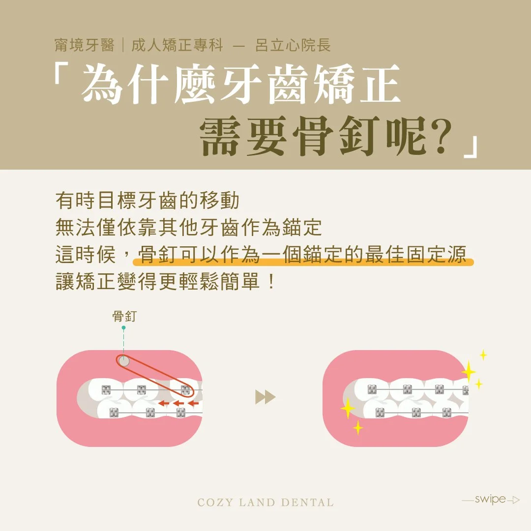 矯正為何需要骨釘說明圖｜作為錨定裝置提供支撐點，改善暴牙深咬戽斗等複雜案例