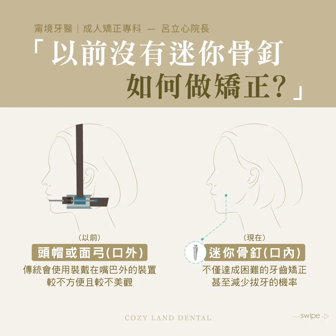 矯正骨釘清潔保養說明圖 4｜骨釘（TAD）周圍清潔方法，牙間刷使用示範，台北大直矯正