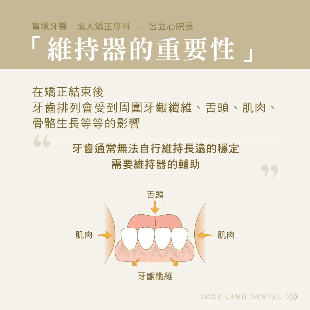 矯正結束後維持器配戴必要性說明圖｜牙齒位移風險與維持器保護效果說明
