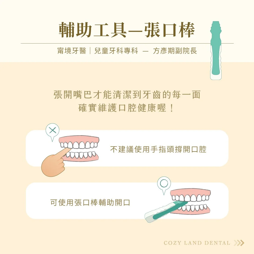 兒童張口棒輔助清潔工具說明圖 5｜避免手指撐口，使用張口棒才能清潔每面牙齒