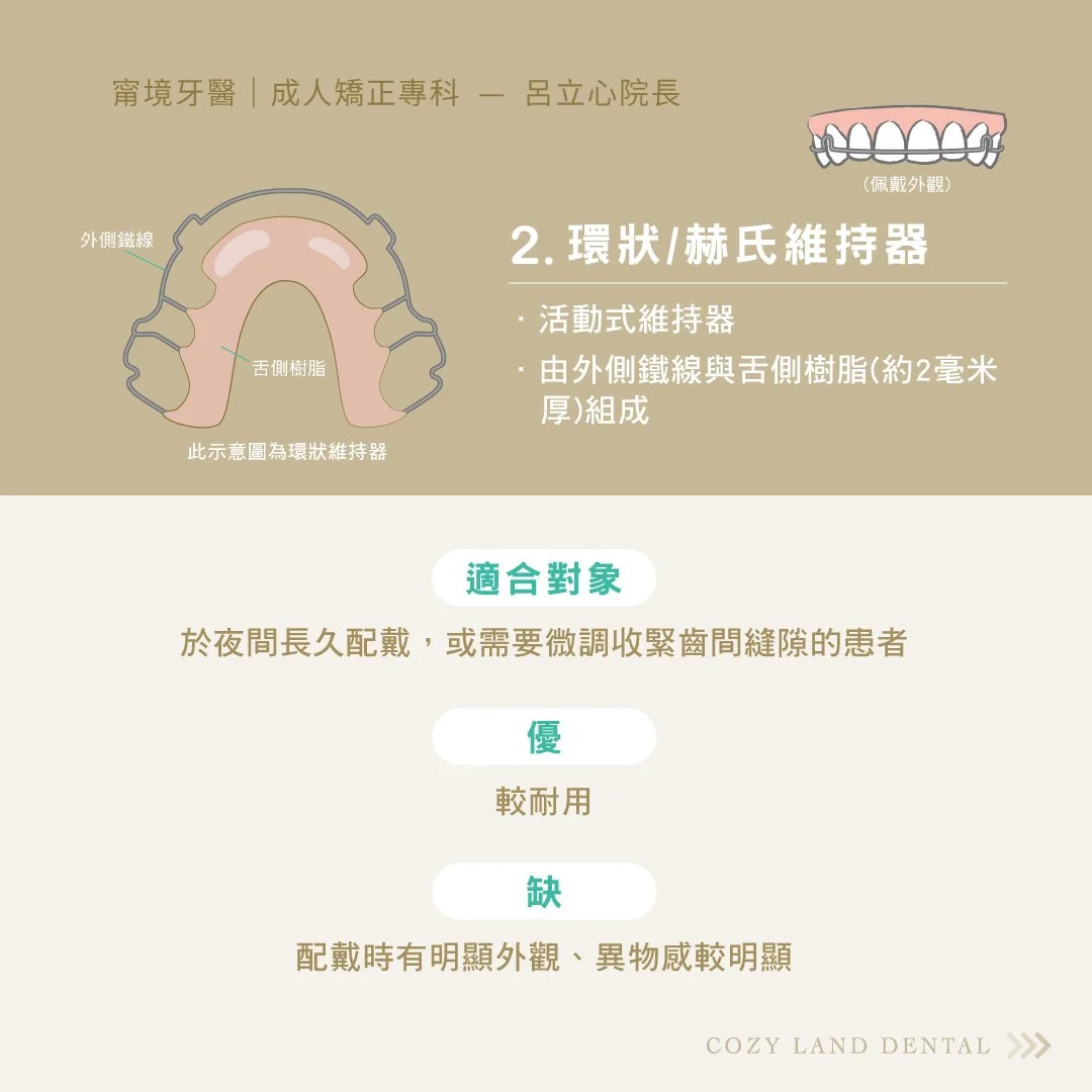 赫氏維持器（Hawley Retainer）介紹說明圖｜外側鐵線+樹脂活動式維持器外觀