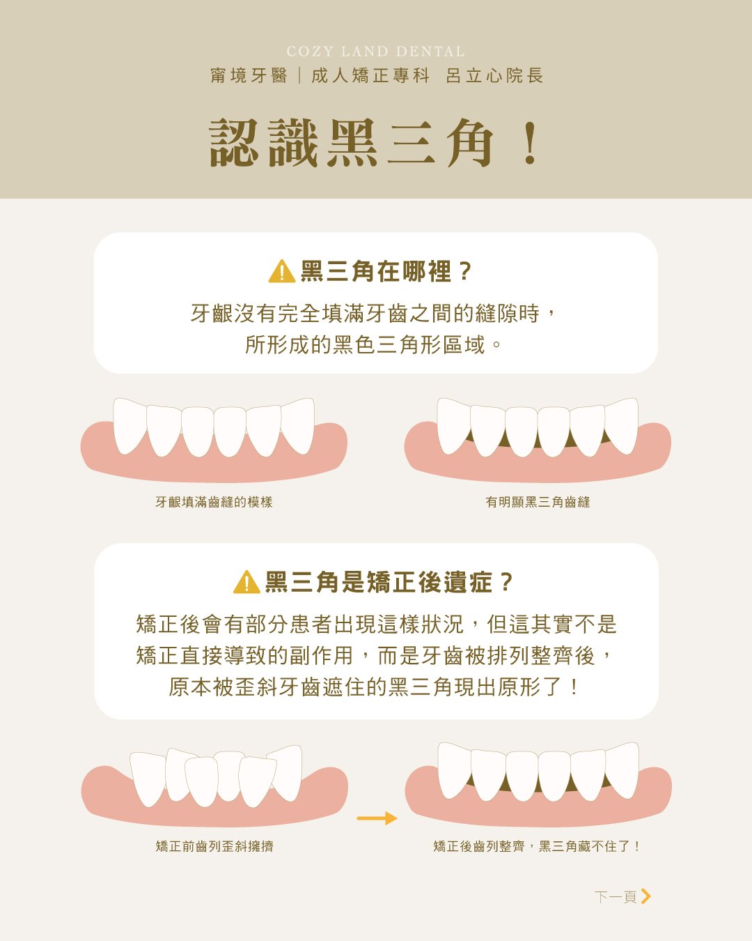 呂-矯正後黑三角-2.jpg