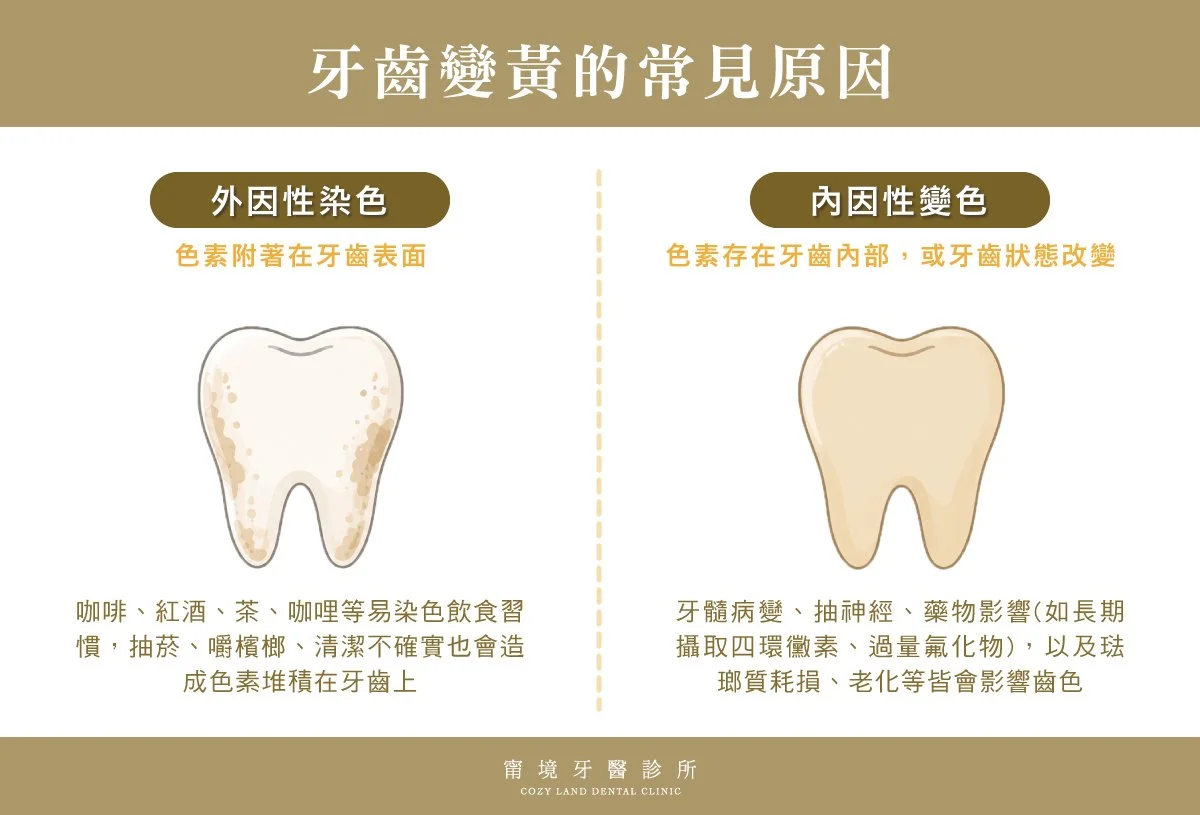 牙齒黃怎麼辦？ 牙齒變黃原因＋美白方法完整解析