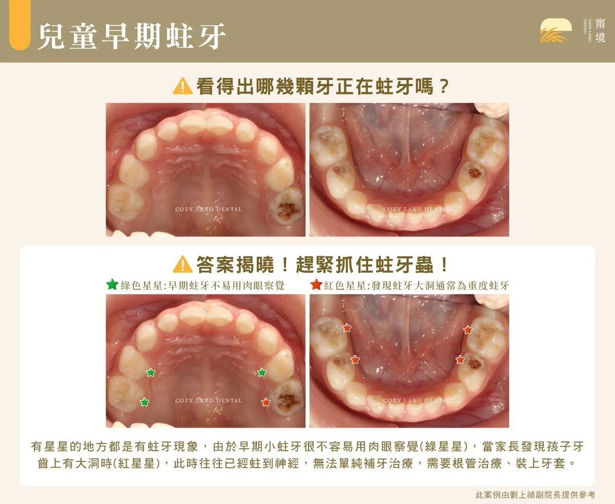 家長協助幼兒正確刷牙示範圖｜預防兒童蛀牙口腔保健步驟