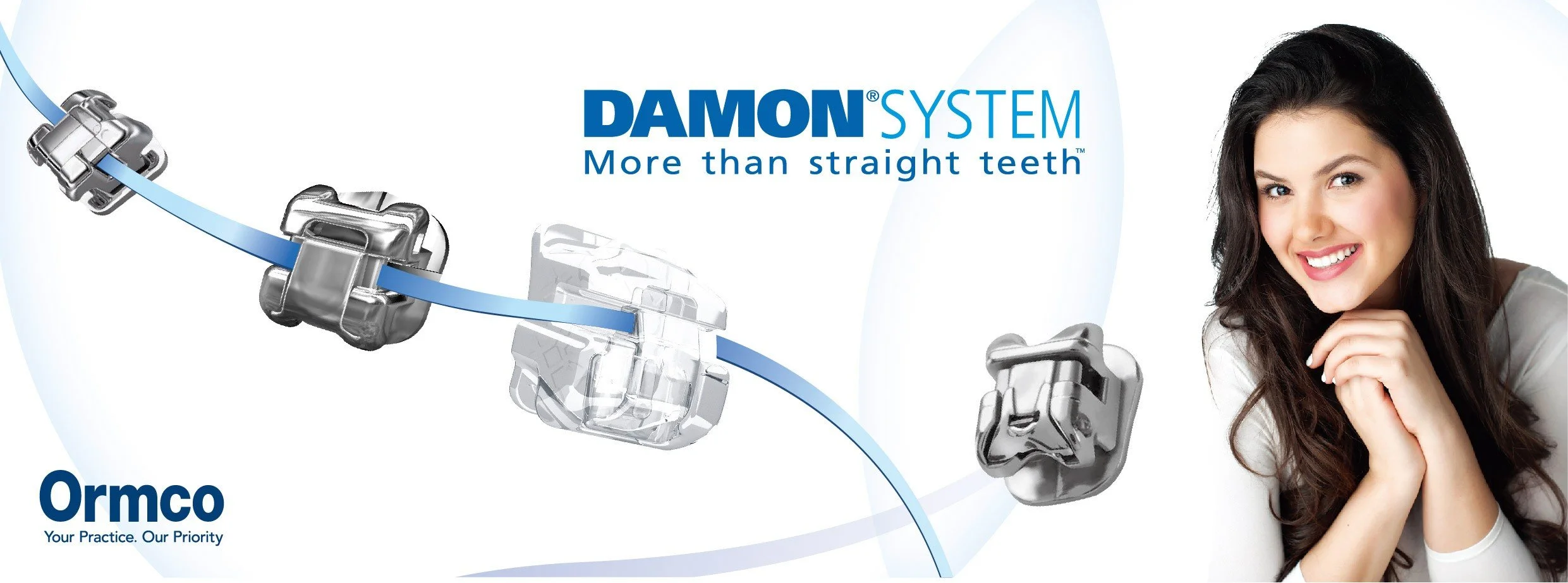 戴蒙牙套（自鎖式矯正器）實物圖｜SpinTek 專利滑蓋設計取代傳統結紮線