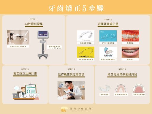 牙齒矯正完整流程圖｜矯正 5 大步驟：諮詢、資料收集、配戴矯正器、拆除、維持器