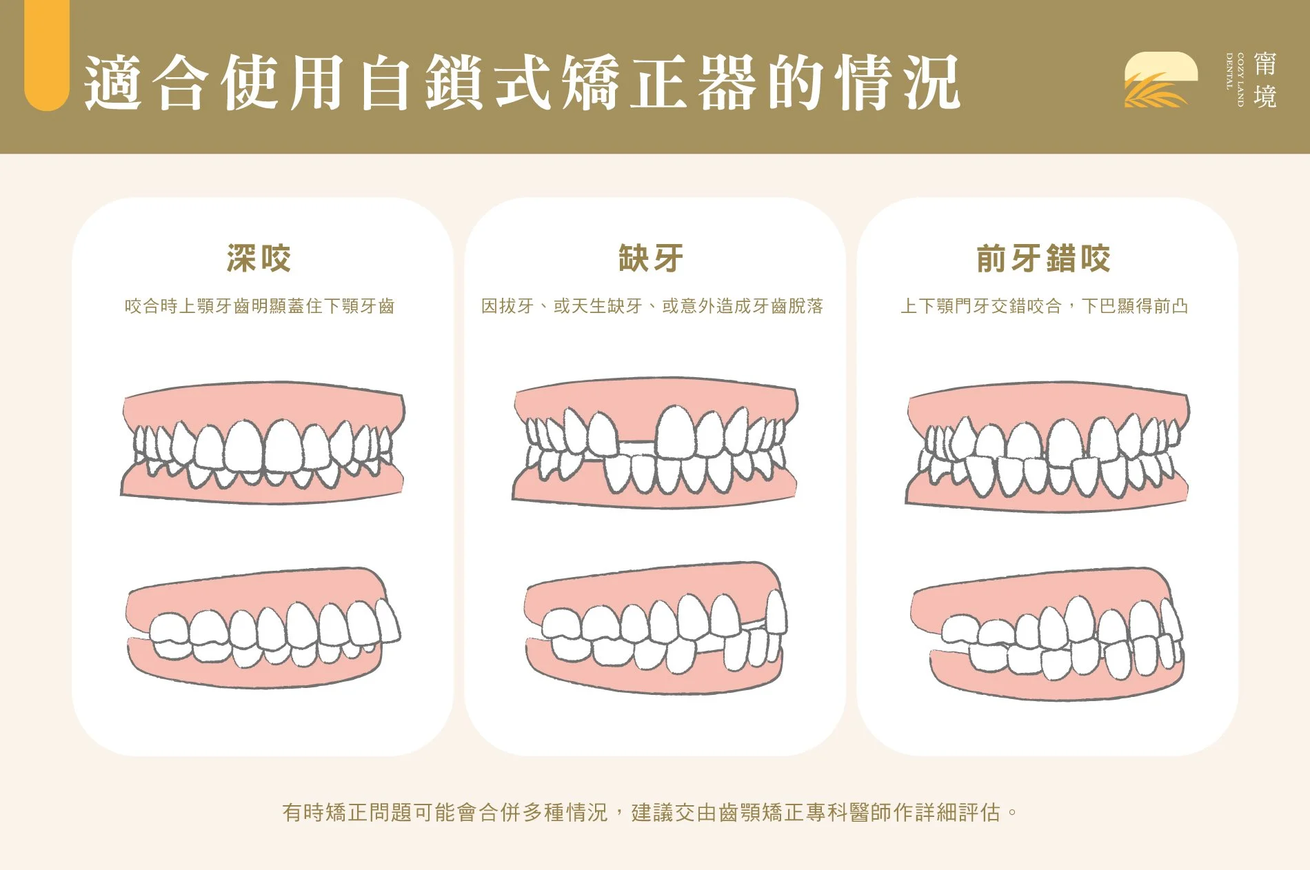 各類矯正方式比較圖｜傳統金屬、陶瓷、隱適美外觀與費用比較