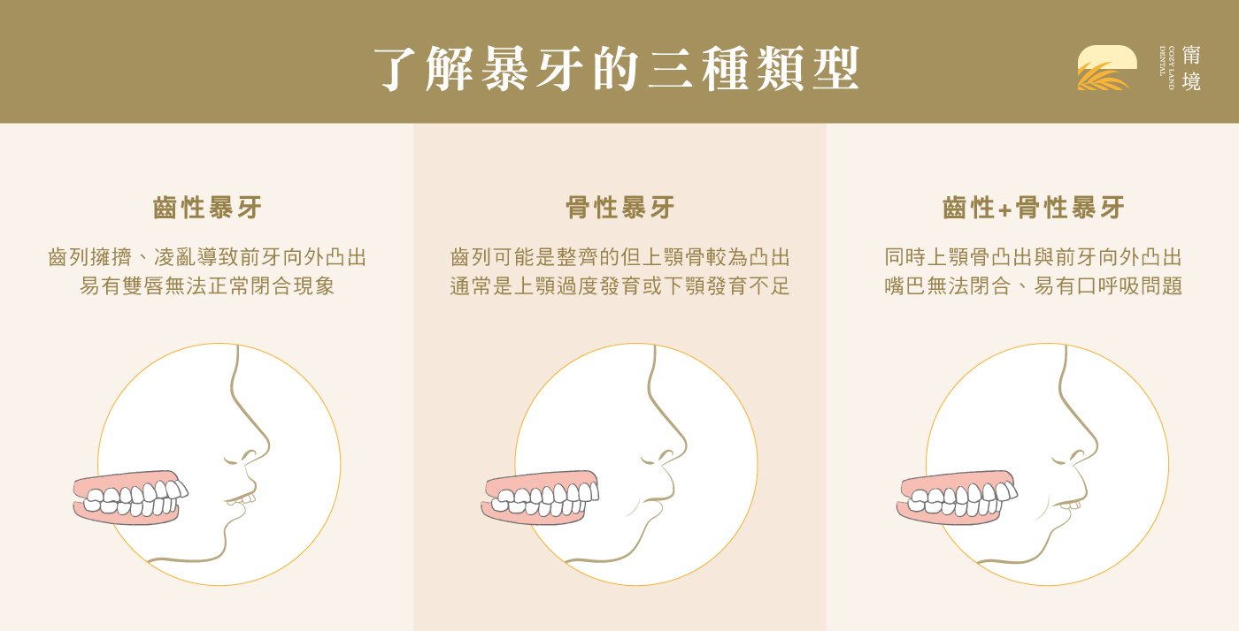 兒童暴牙 3 種類型分類圖｜齒性暴牙、骨性暴牙、齒性骨性暴牙差異比較