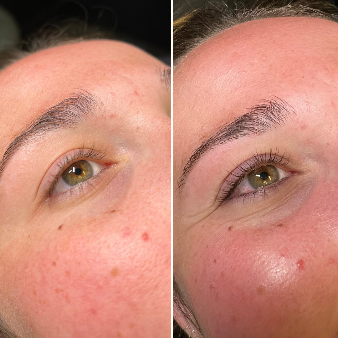Ivory Minimalist Before and After Skincare Beauty Instagram Post-3.png