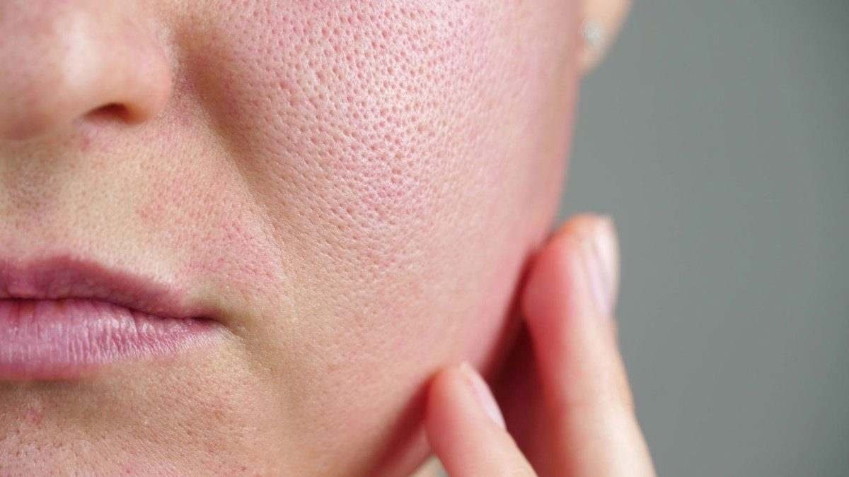Do you think you have sensitive skin? The good news is that chances are, you don’t. Hear us out.