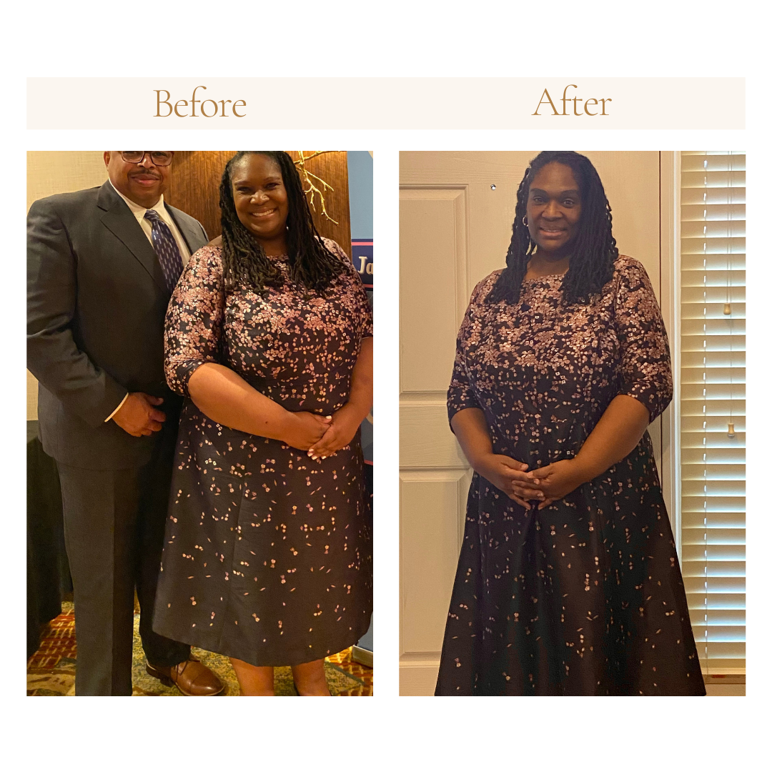 Side-by-side comparison of a person in a floral dress labeled "Before" and "After," showing weight loss.