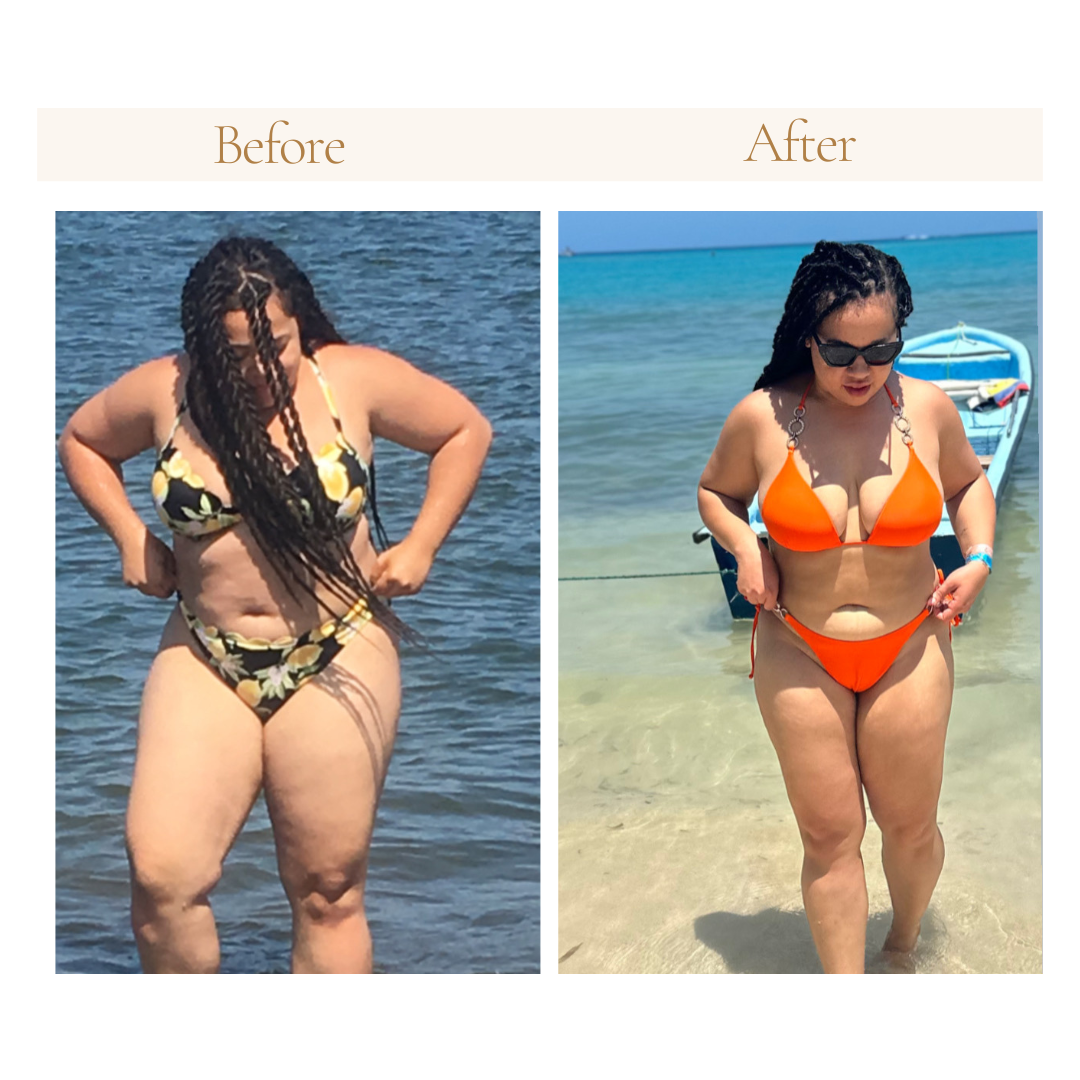 Before and after weight loss photos of a woman in different bikinis at the beach.