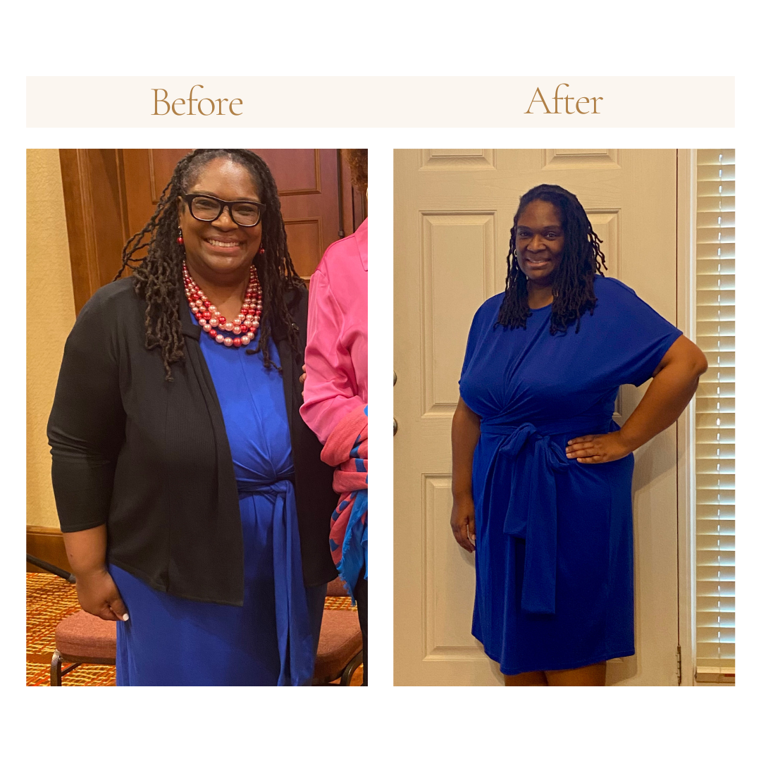Before and after weight loss transformation of a woman in a blue dress.