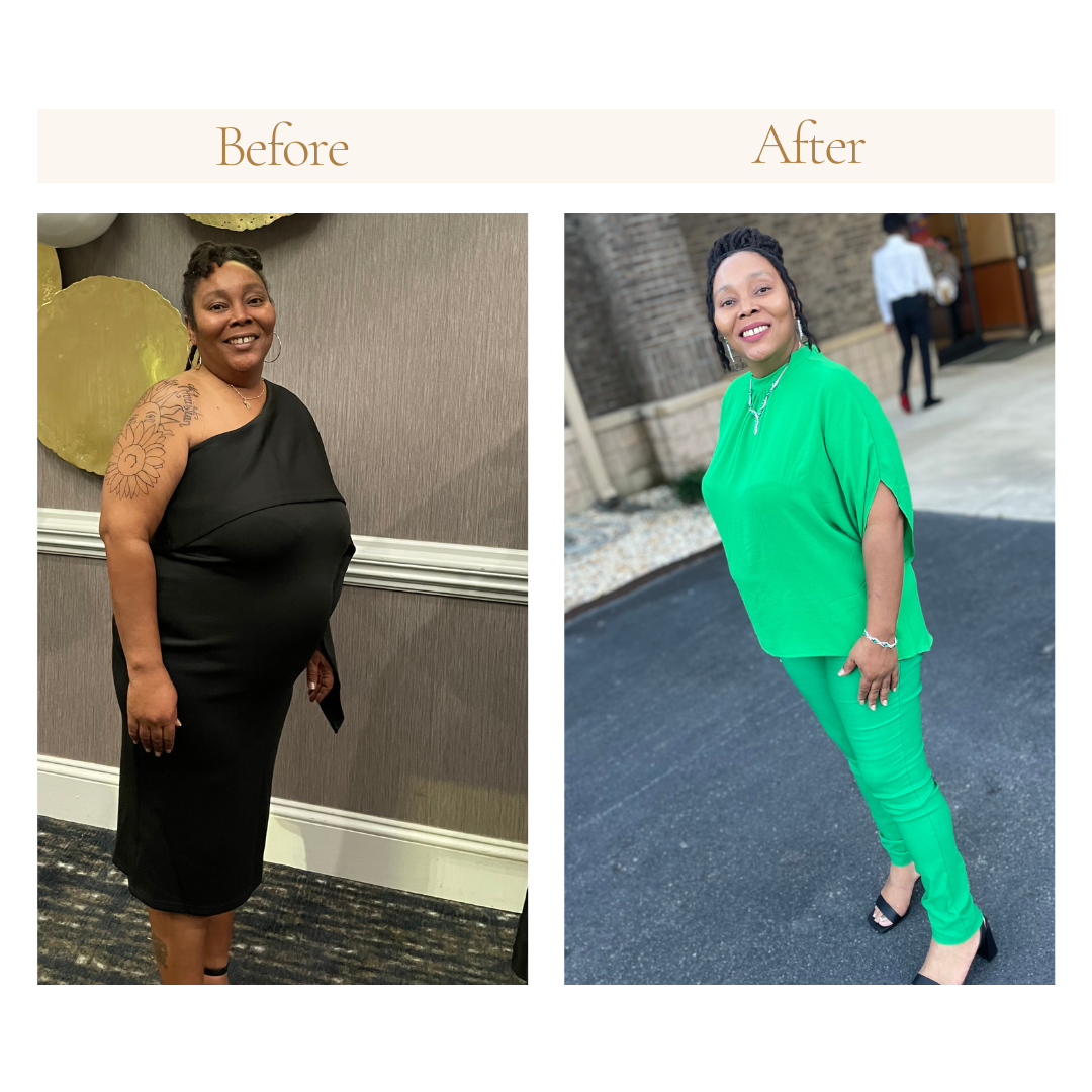 Side-by-side comparison of a woman in "before" and "after" photos, showcasing a transformation. In the "before" image, she is wearing a black dress. In the "after" image, she is dressed in a green outfit, standing outside with a noticeable change in 