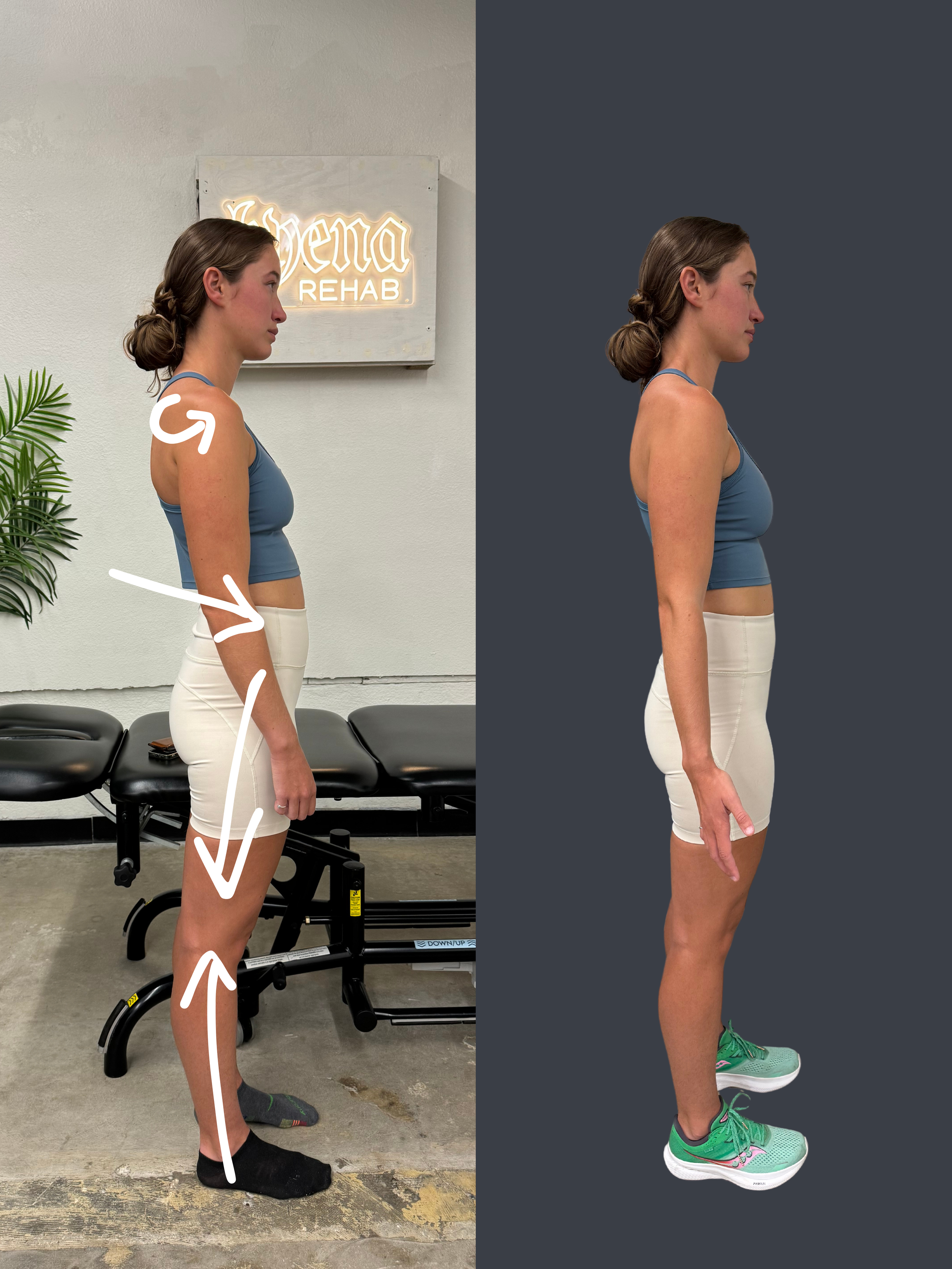 How to Choose the Right Physical Therapy Provider for Chronic Pain &amp; Performance in Los Angeles