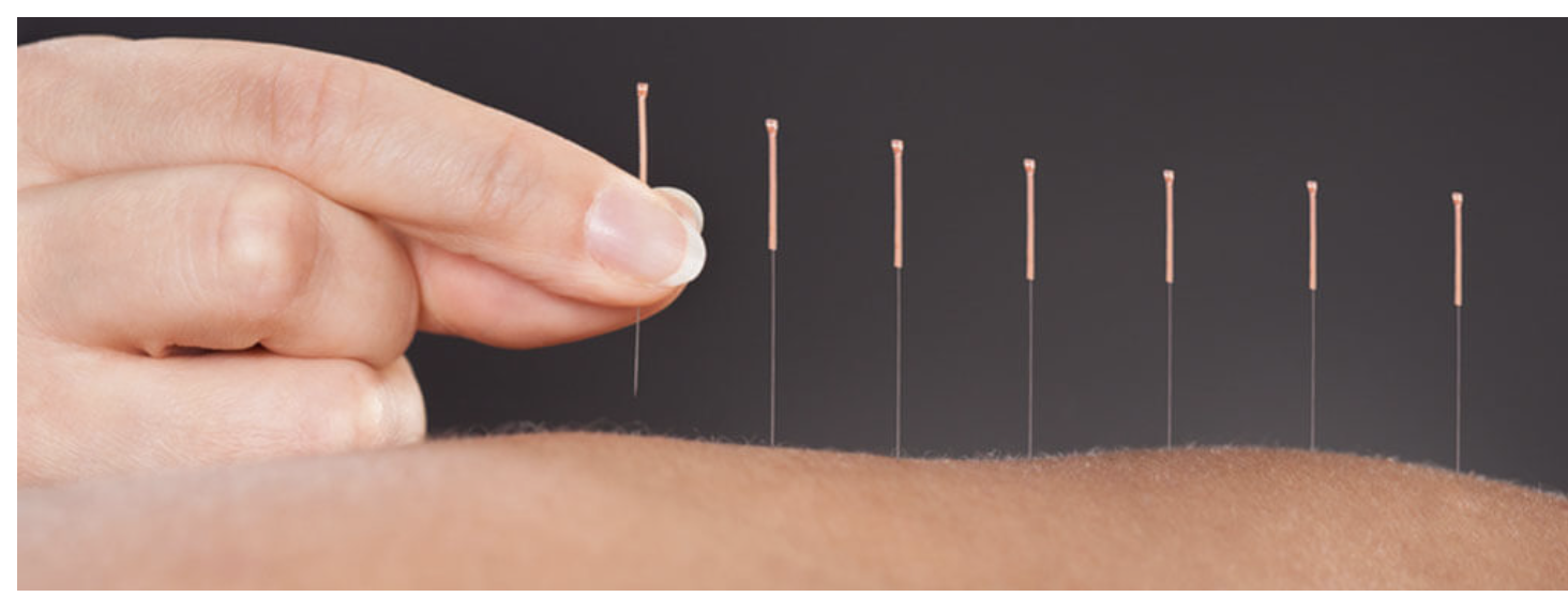 Yen Le Cary Raleigh NC Acupuncture — MY SHEN MEDICINE