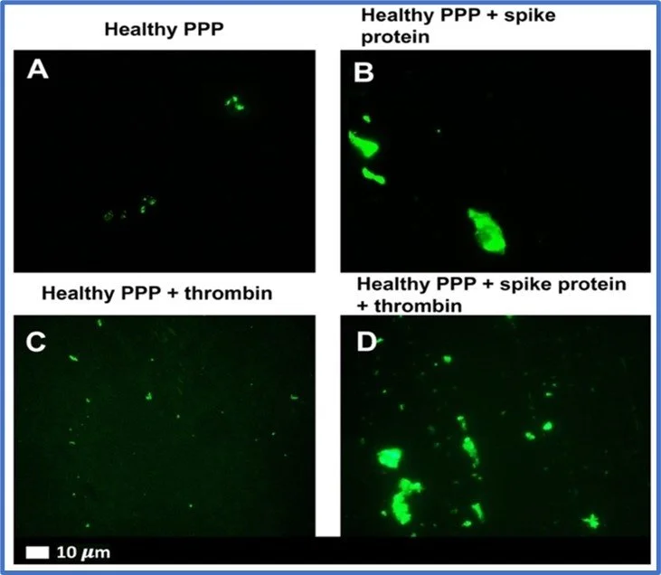 Microstolsels in Long COVID