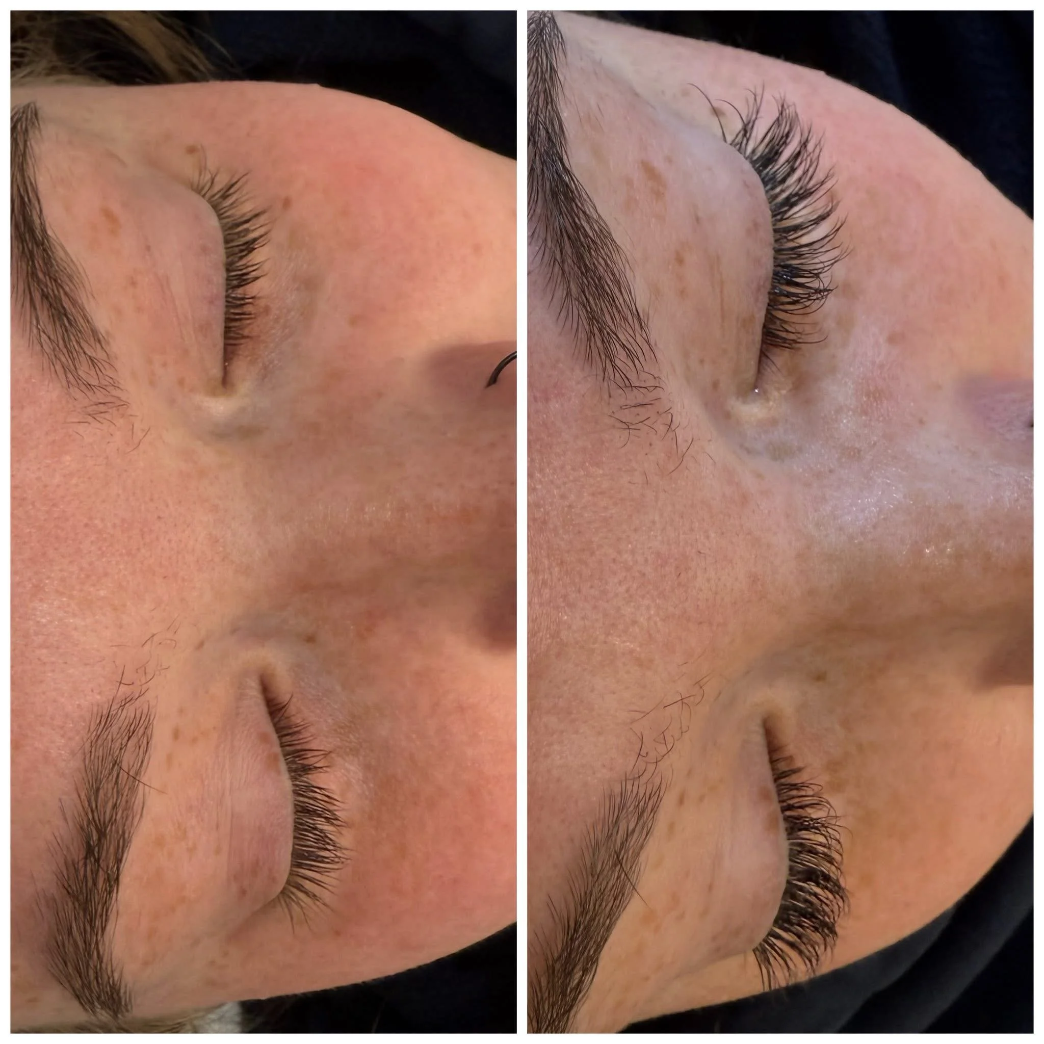 before and after photo of classic lash extensions showing a woman with eyes closed and noticeably longer dark eye lashes