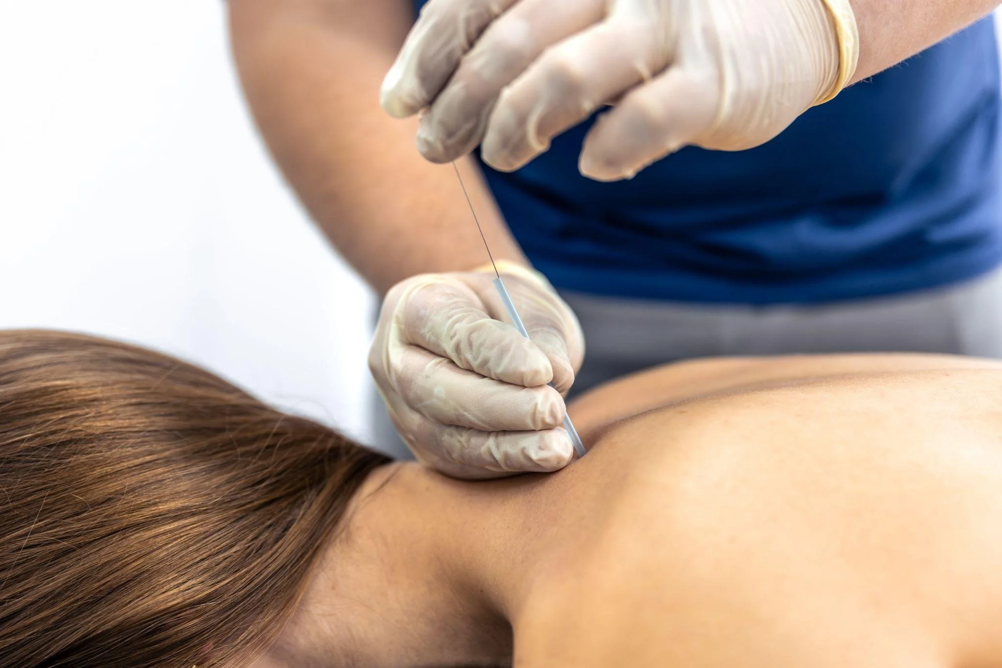 Neural Therapy Injection