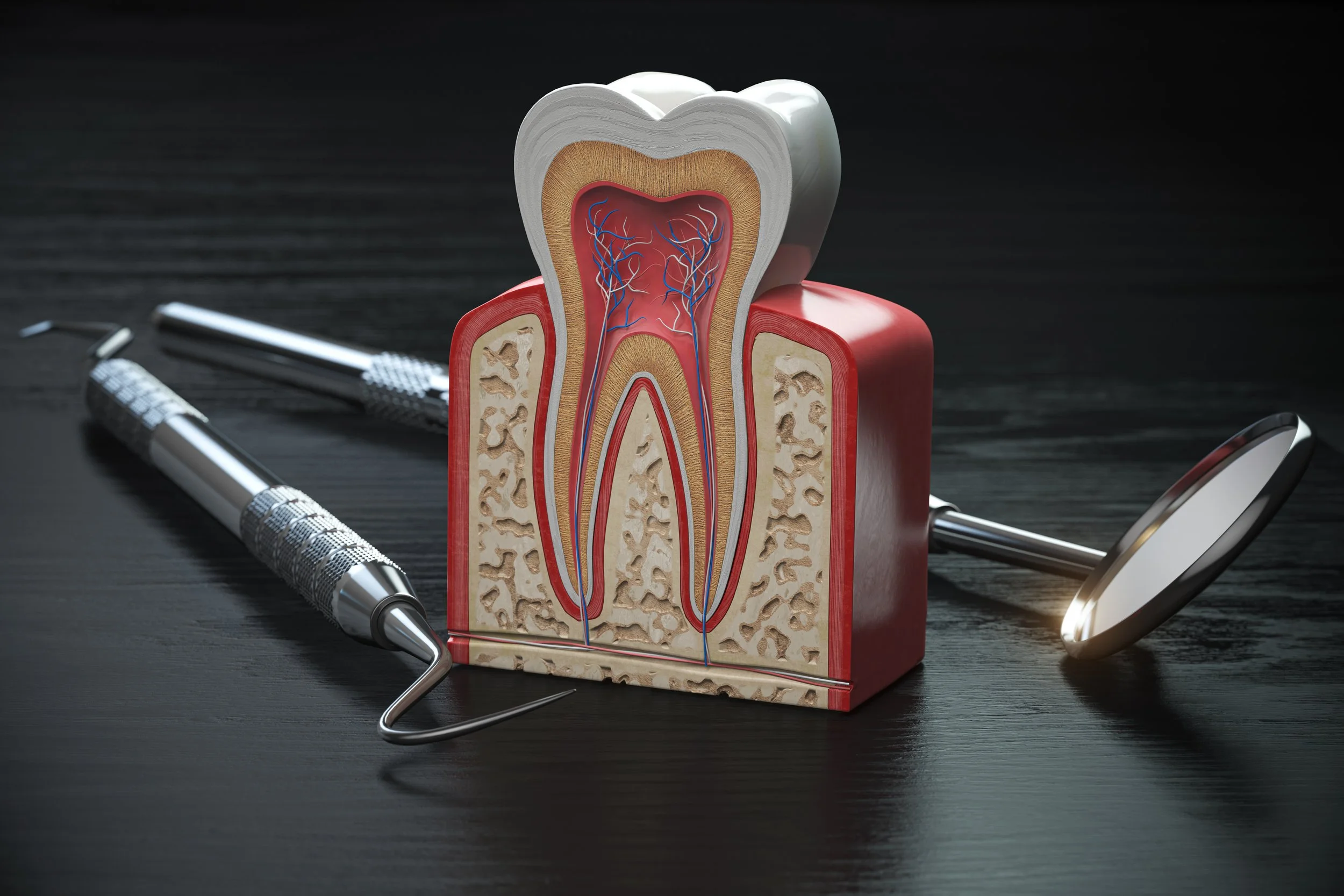 How do you know if you need a root canal?
