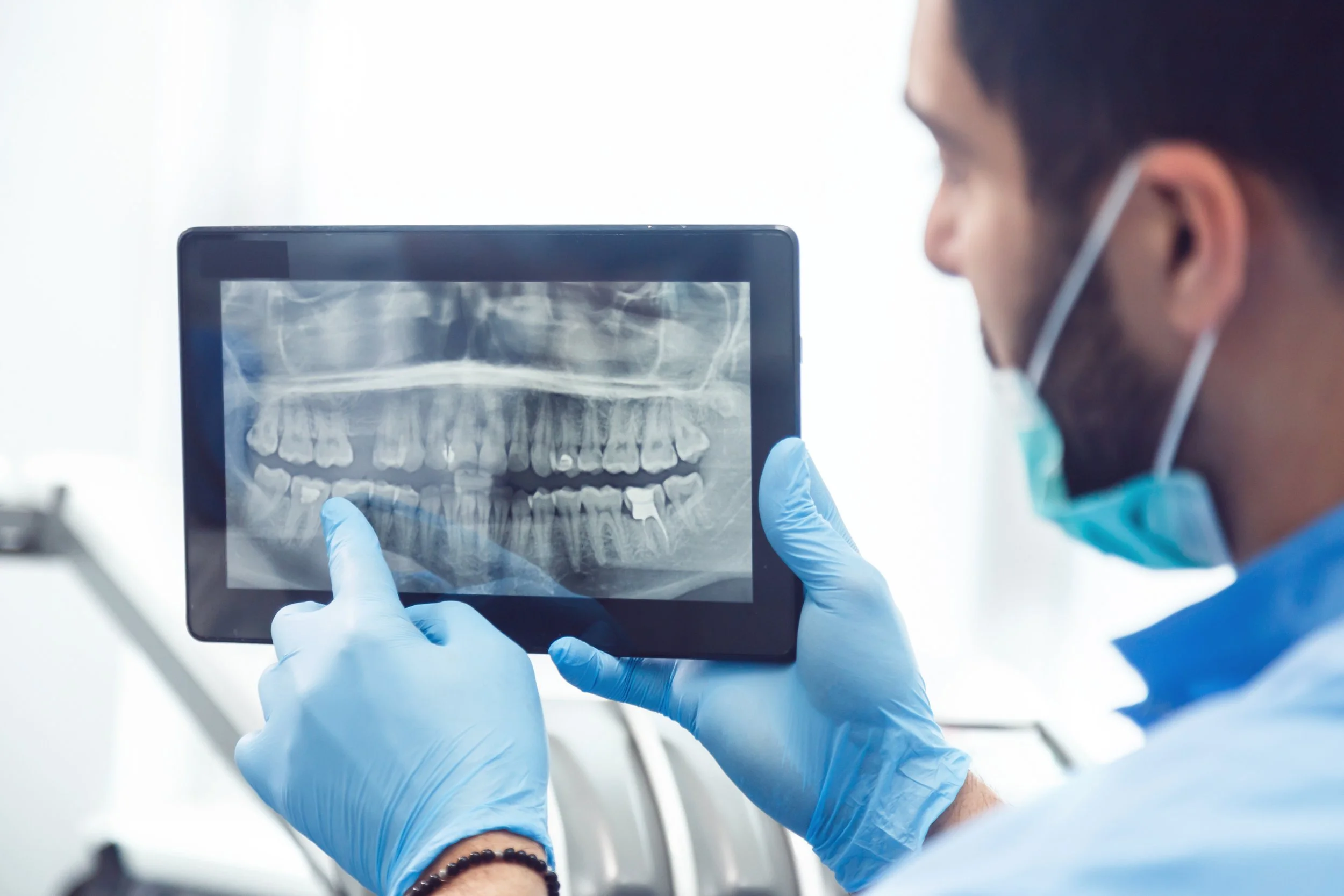 Are Dental X-rays Safe?