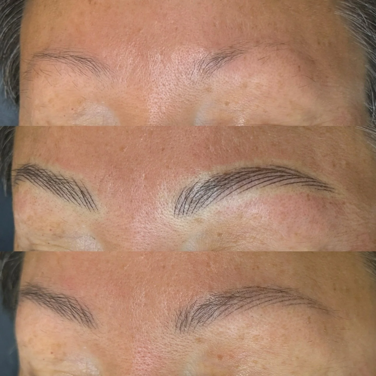 HEALED nano brows after one session 🫧

Real, raw photos. Building a brow!!! Love to see it. We were both so happy with this soft result. 

Products used:
&bull; @lipigmentsglobal @girlzinkstudio Pigments in &ldquo;Navajo brown&rdquo; + &ldquo;Ebony 