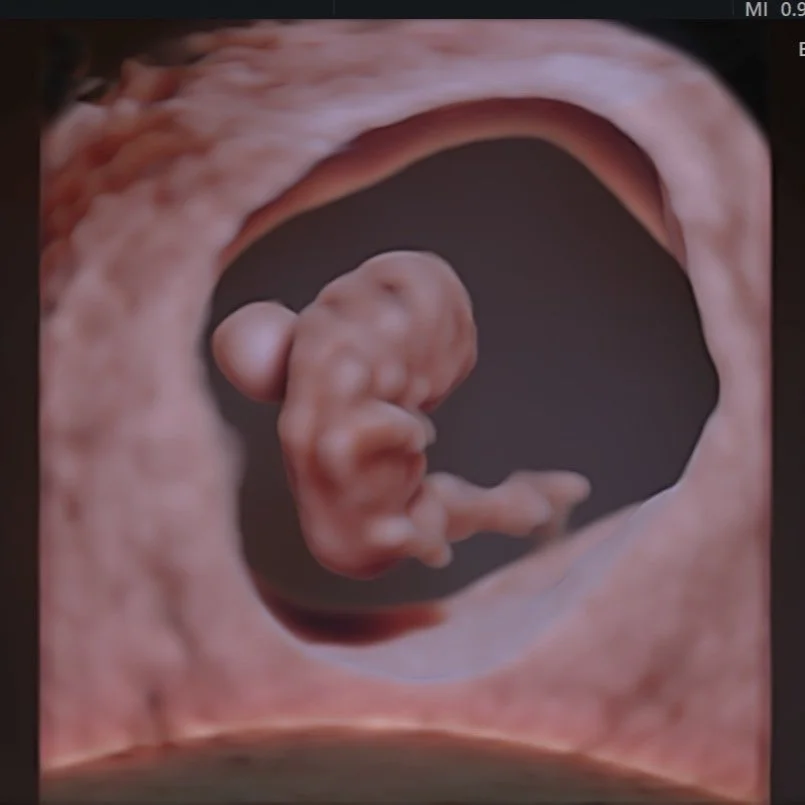 Dating Scan Radiop Dating Scans — Trinity Imaging