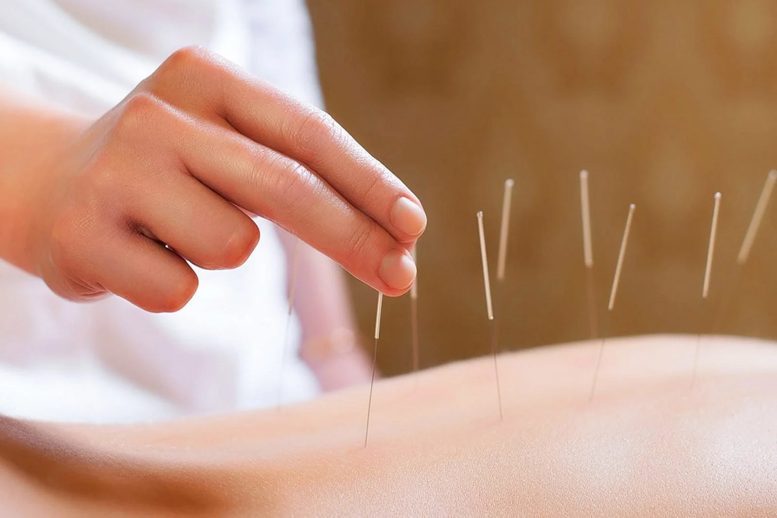 medworld-Acupuncture.jpg