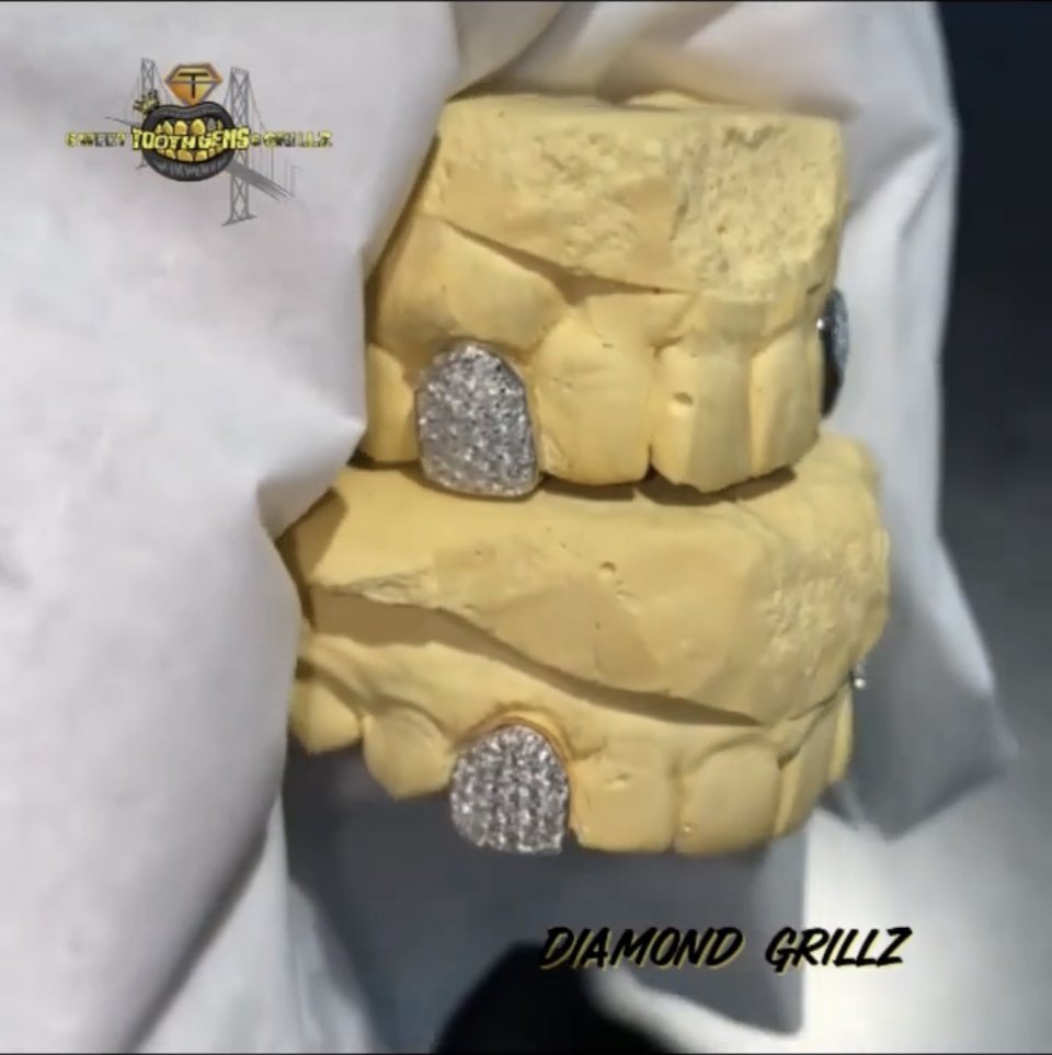 Diamond BUSTDOWN Grillz | Hella Tooth Gems and Grillz - Sweet Tooth Gems and Grillz
