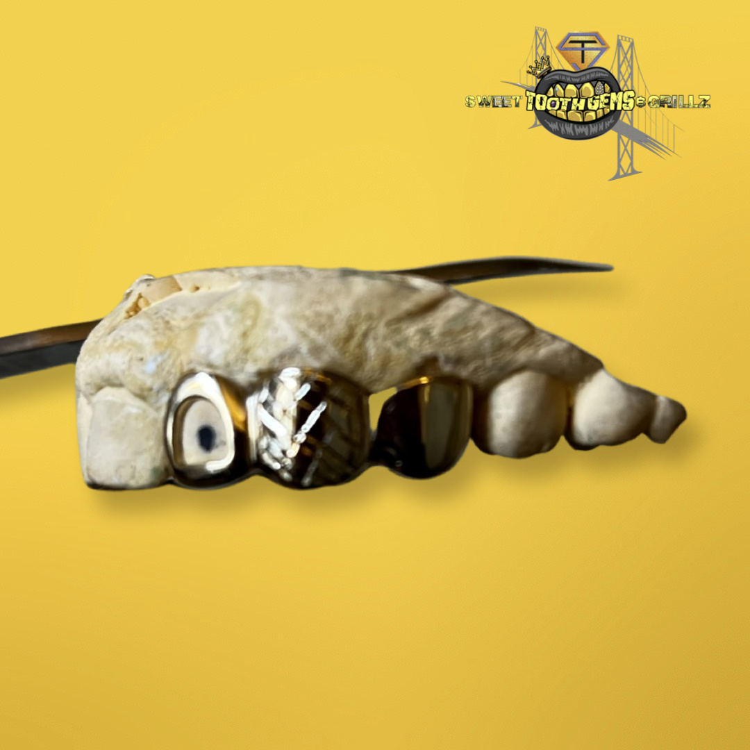 Shop Tooth Gem Kits Sweet Tooth Gemz and Grillz Oakland — Sweet