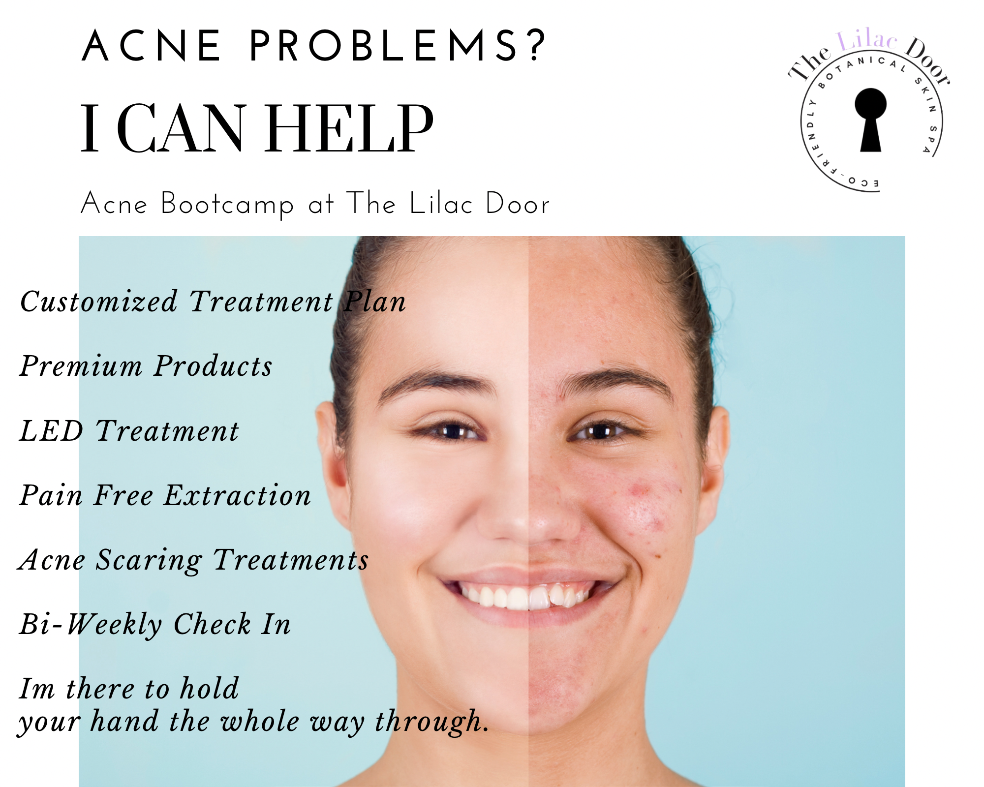 acne bootcamp novi face reality