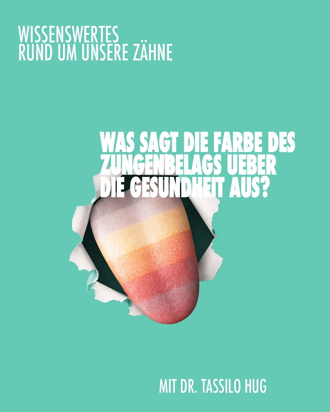 𝐃𝐢𝐞 𝐙𝐮𝐧𝐠𝐞 𝐯𝐞𝐫𝐫𝐚̈𝐭 𝐦𝐞𝐡𝐫, 𝐚𝐥𝐬 𝐦𝐚𝐧 𝐝𝐞𝐧𝐤𝐭! 👅
Zungenbelag ist nicht automatisch ein Grund zur Sorge, aber dessen Farbe kann Hinweise auf den jeweiligen Gesundheitszustand geben. Ein wei&szlig;licher Belag entsteht h&auml;ufig