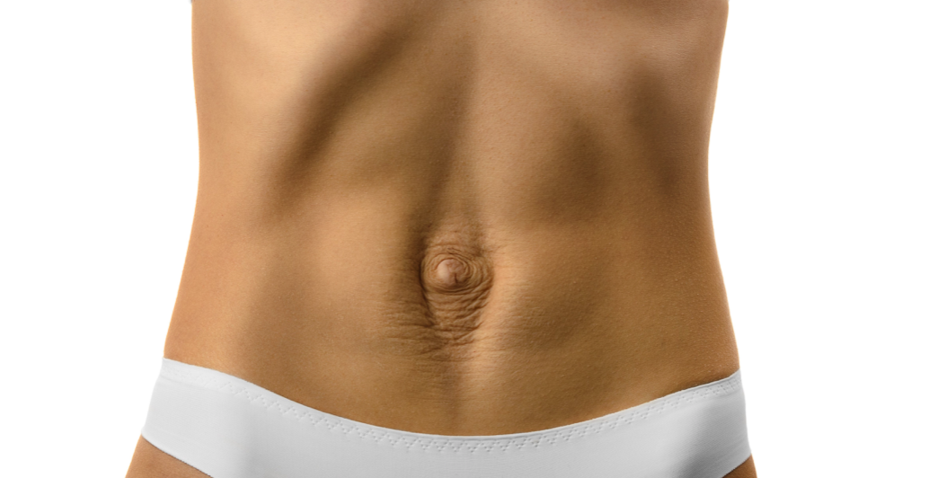 Diastasis Recti Awareness Month  