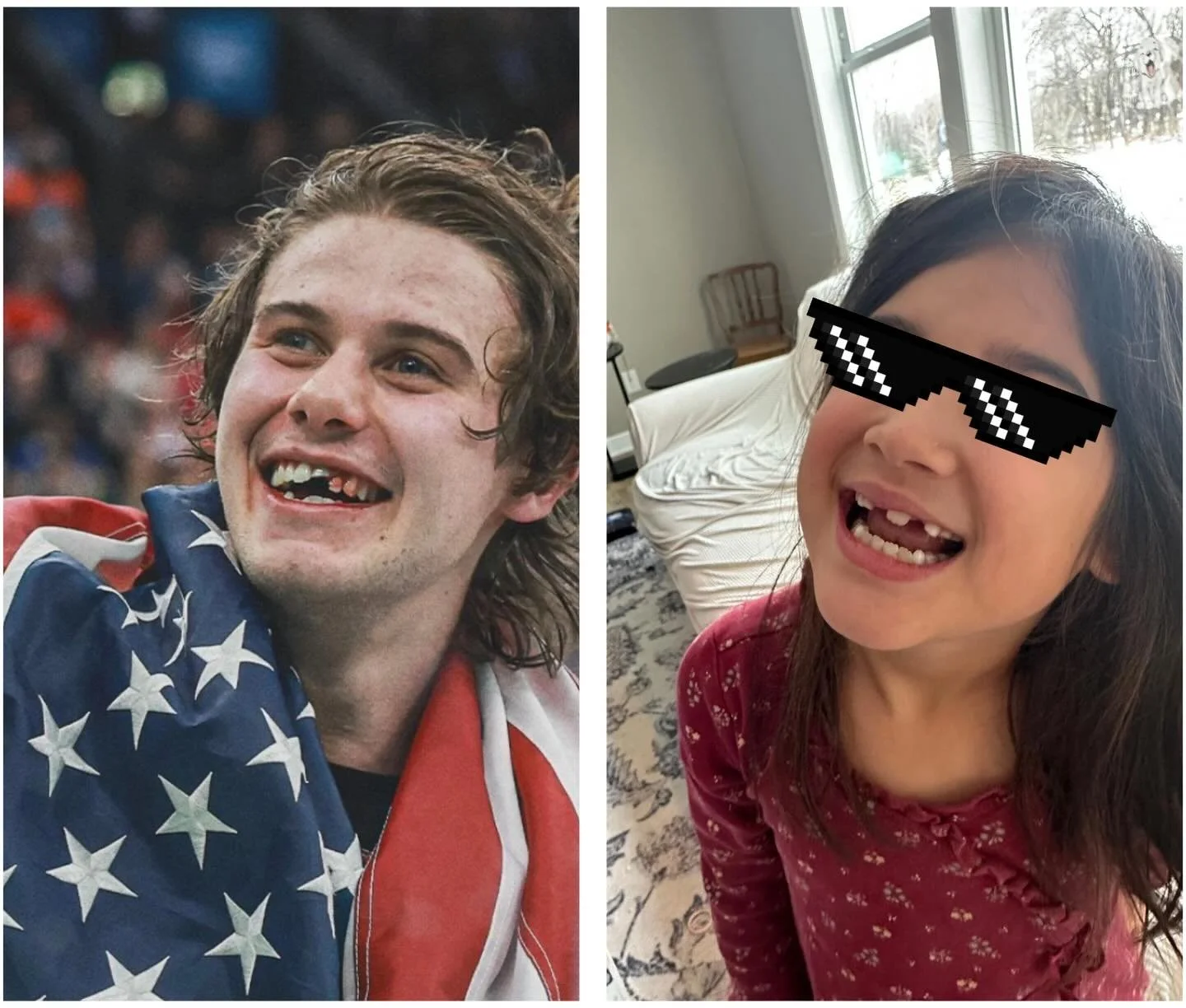 Who wore it better?

#USA #hockey #freebird #olympics #dentist