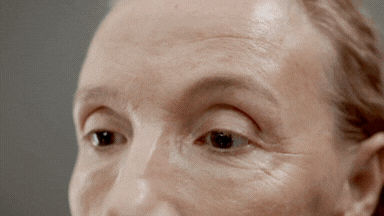 Close-up of a person's face with light skin and brown hair, focusing on the forehead and eyes.