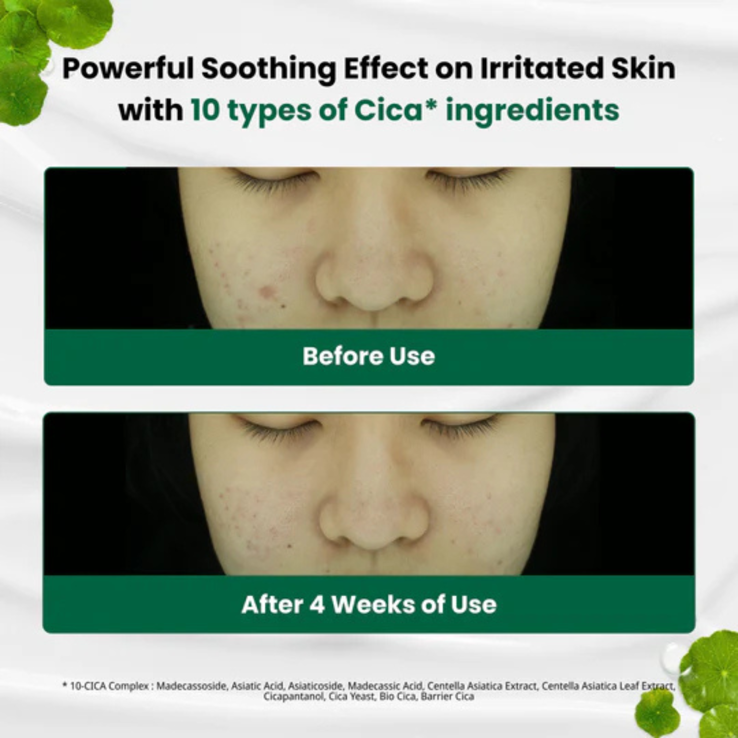 Dr.G Red Blemish Cica Soothing Cream 70ml | OoshTush | Kbeauty | Korean Skincare | Free Shipping Over $40