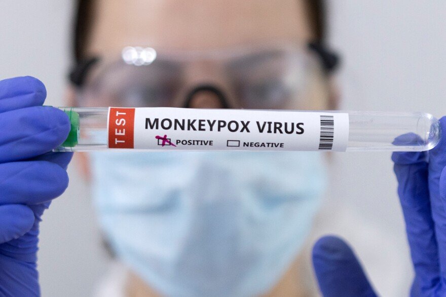 It’s in the Water: Pathogen Detection Sensors Monitoring Wastewater for Monkeypox