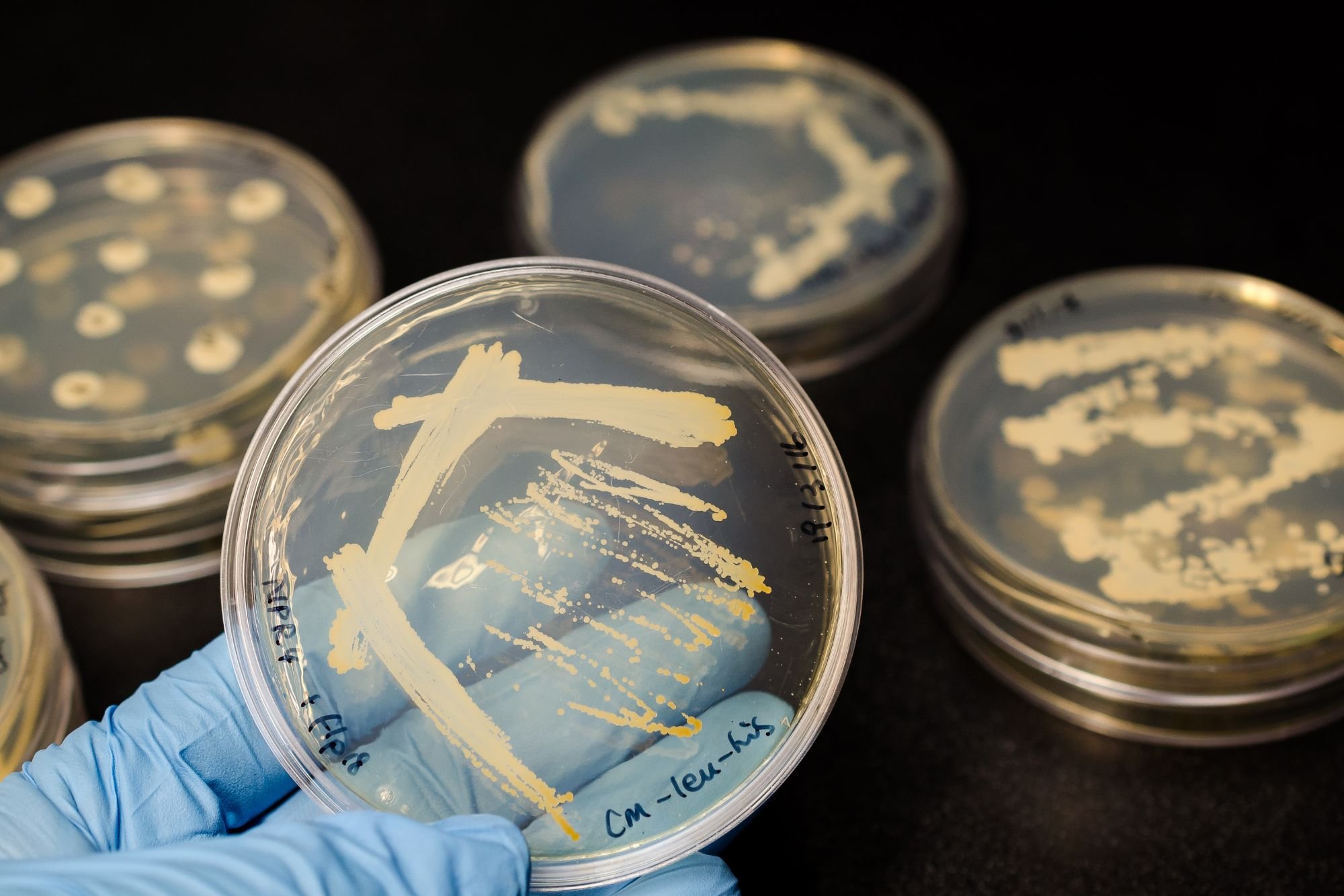 Lab Coli Scope Why Your Lab E. coli Results Are Lying to You — Kraken Sense
