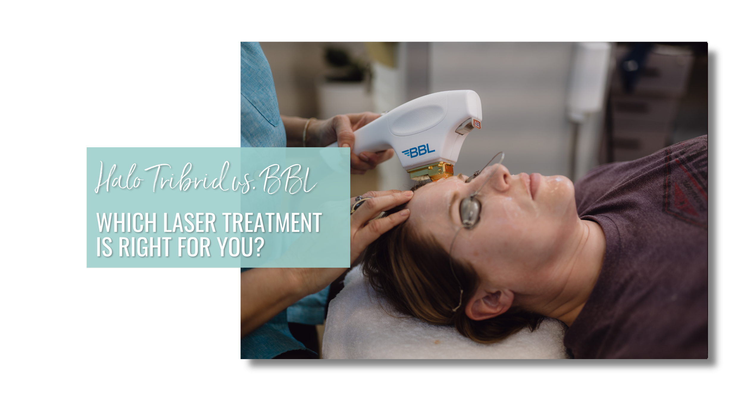 Halo Sciton Tribrid vs. BBL Hero: Which Laser Treatment Is Right for You?