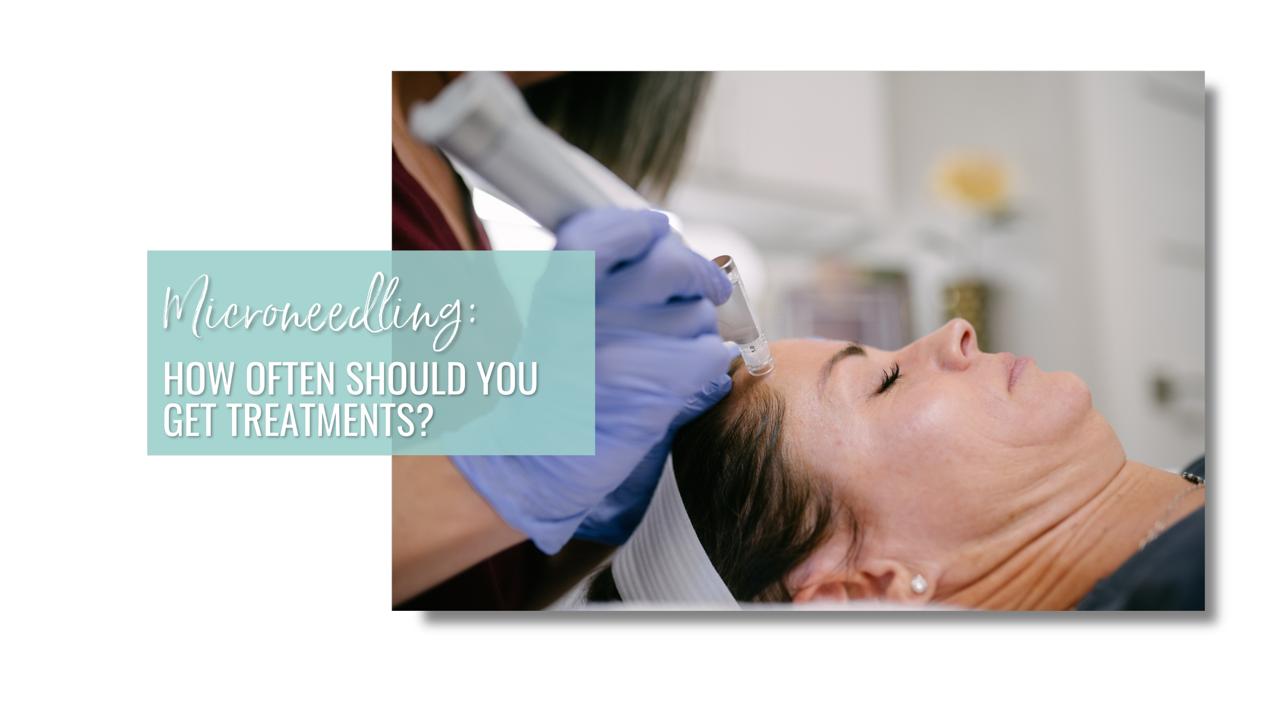 How Often Should You Get Microneedling?