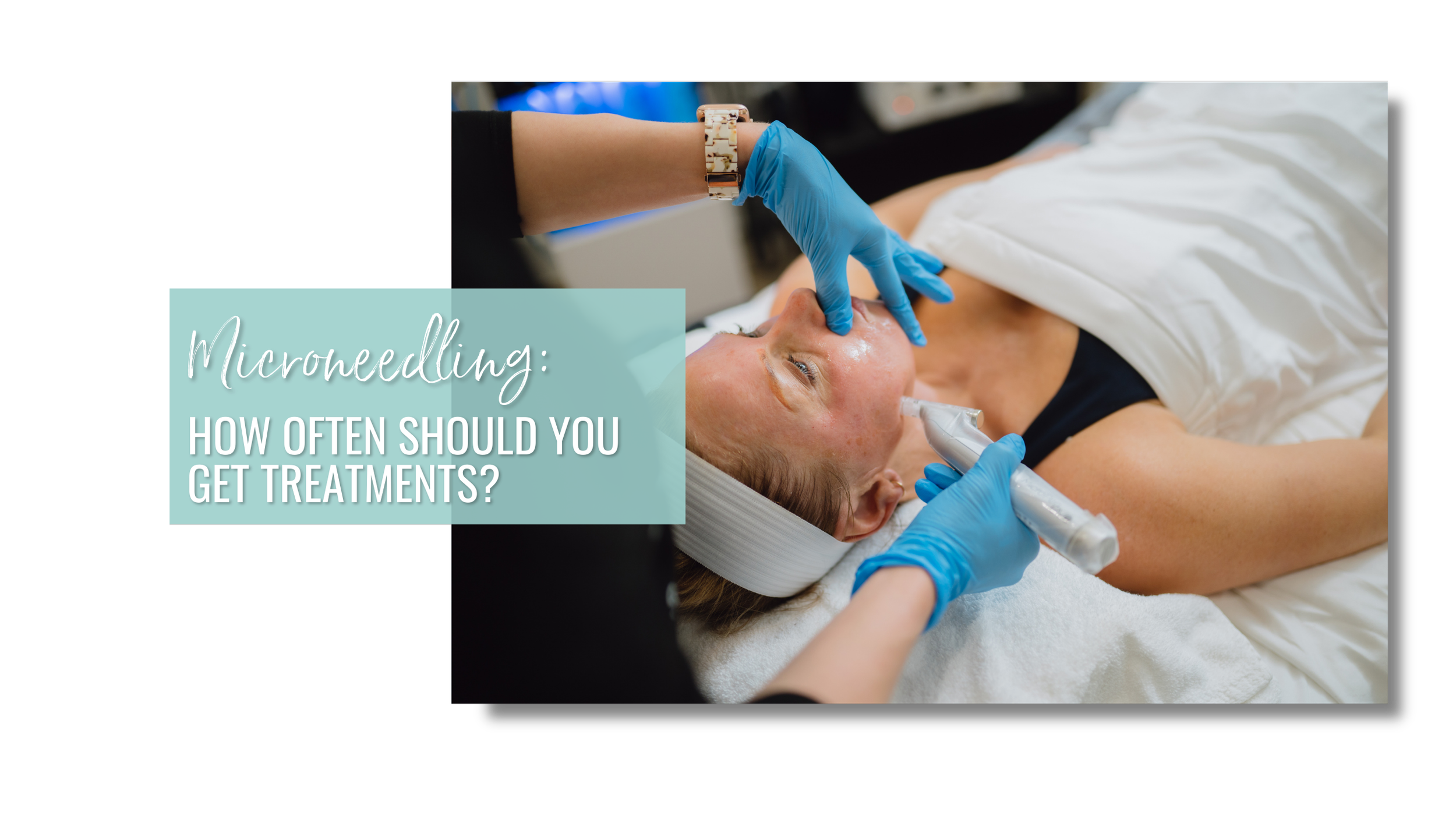 How Often Should You Get Microneedling?