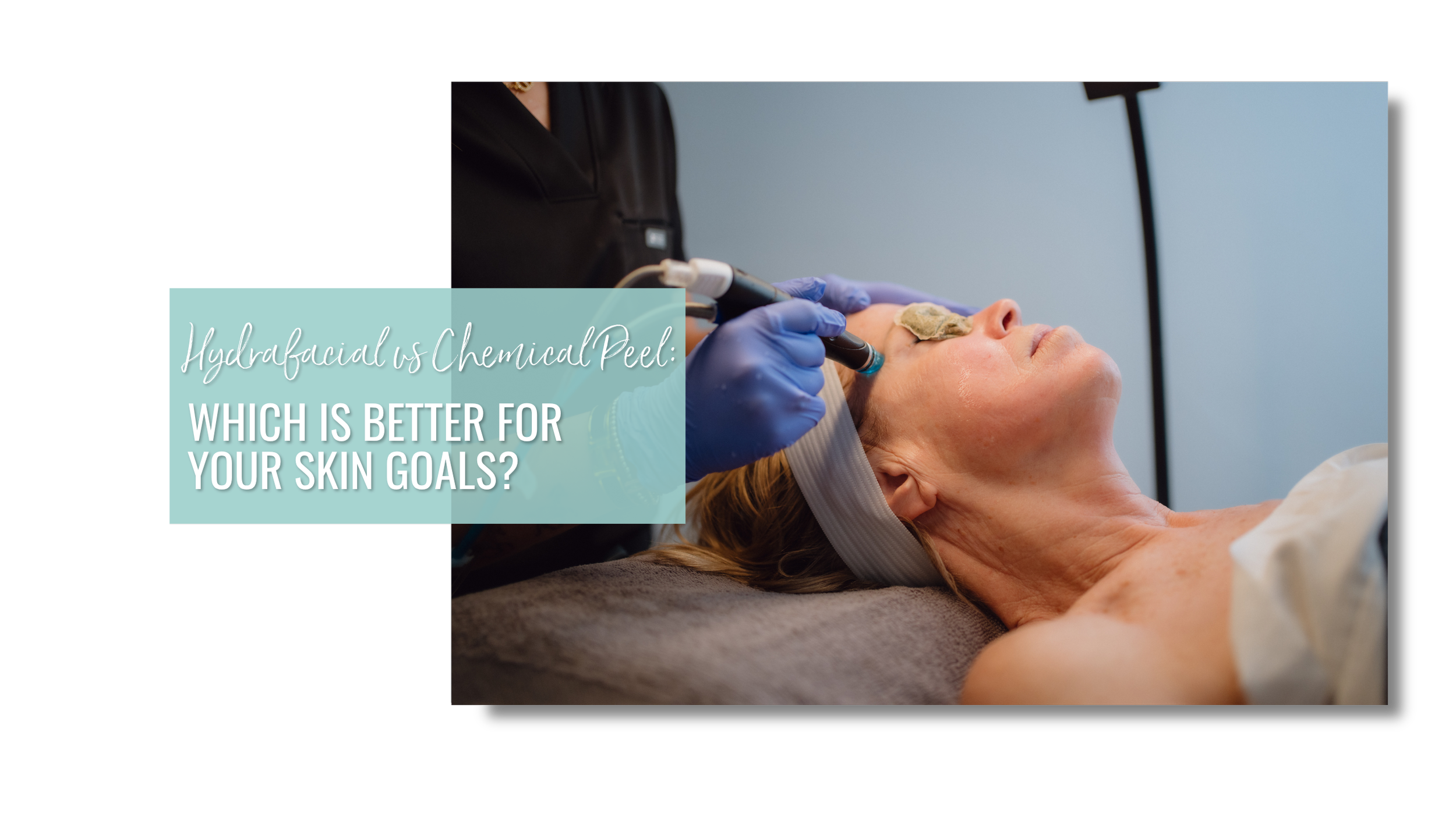 HydraFacial vs Chemical Peel: Which Is Better for Your Skin Goals?