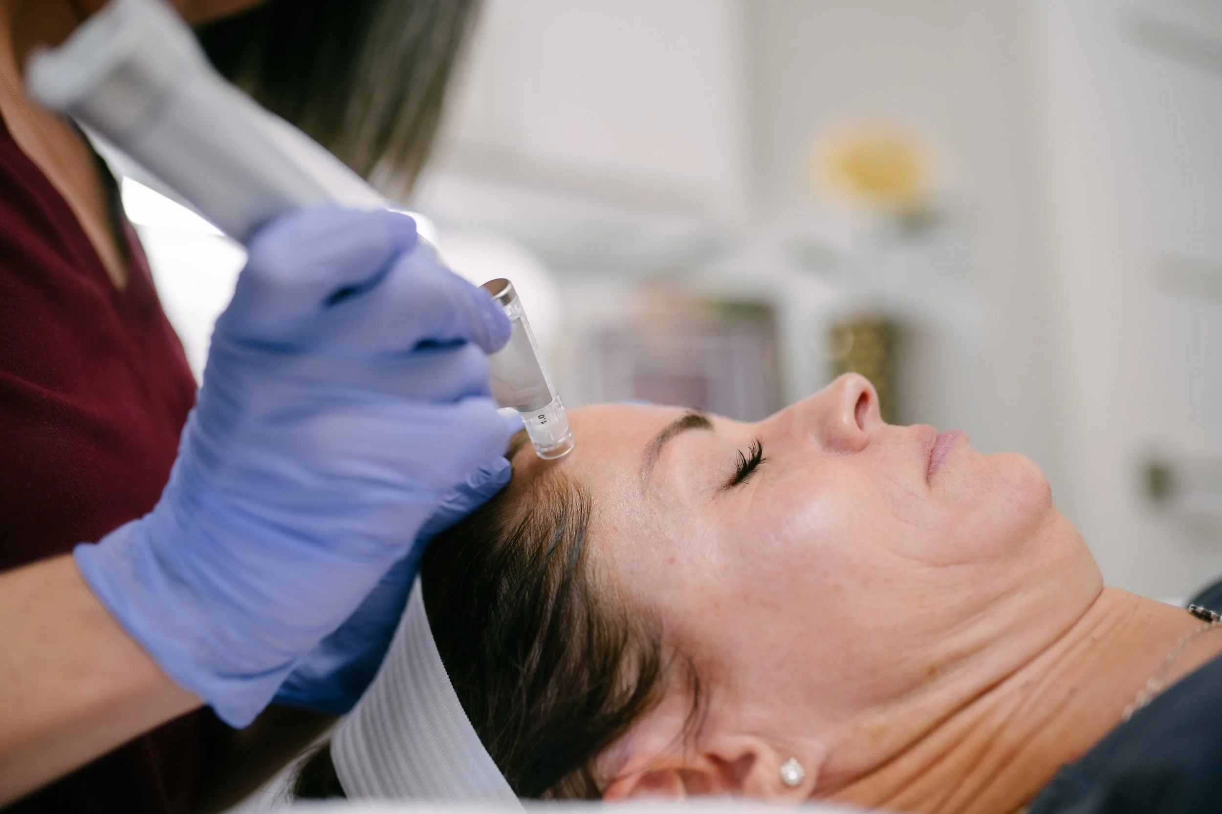 Microneedling treatment at O Young MD in Kerrville Texas