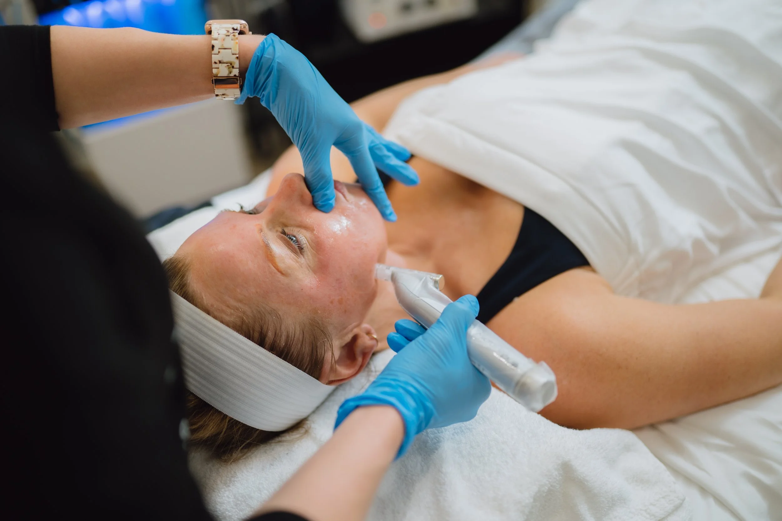 Skin rejuvenation with microneedling at O Young MD Kerrville TX