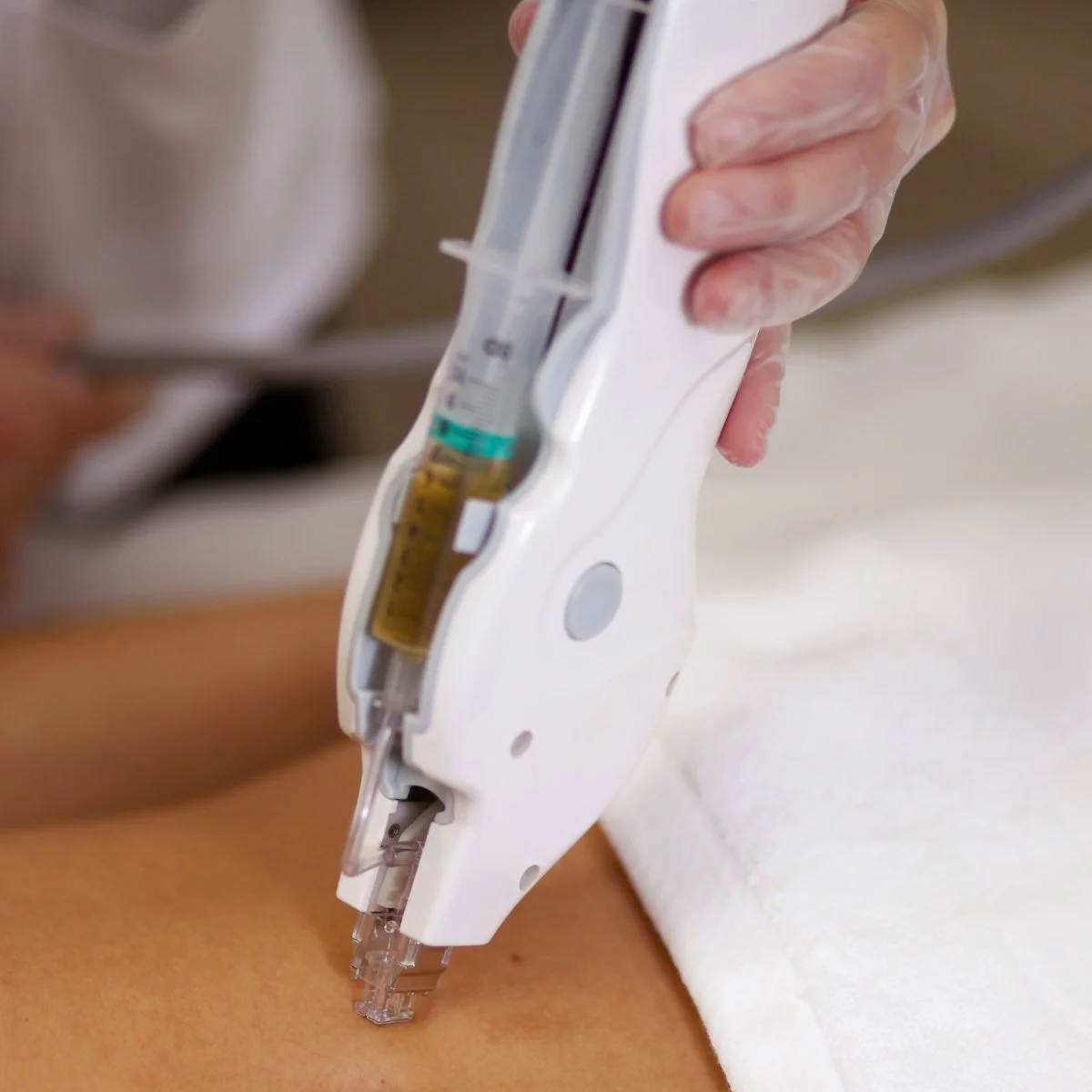 o young kerrville texas tkn mesoject gun laser